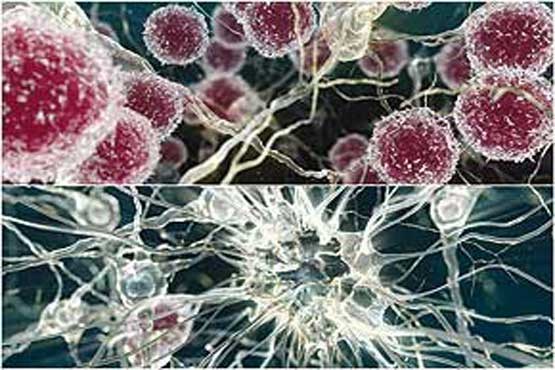 مرموزترین بیماری قرن