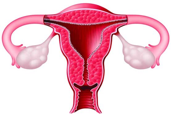 یافته جدید محققان برای جلوگیری از سرطان تخمدان در زنان