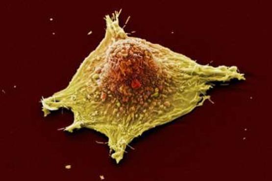 راه کار جدید برای مقابله با سرطان راه کار جدید برای مقابله با سرطان