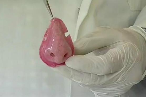 بینی مصنوعی ناجی انسانها می شود