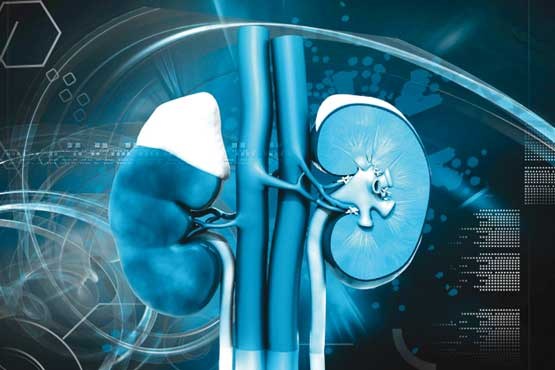 کلیه یدکی برای روز مبادا