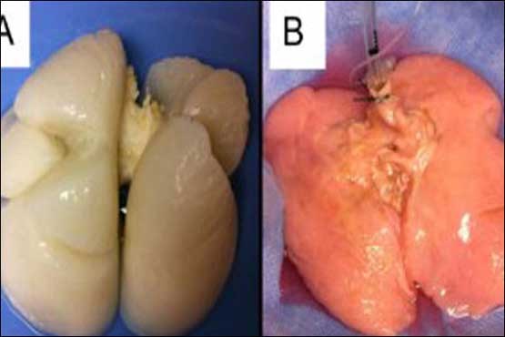 تولید ریه در آزمایشگاه