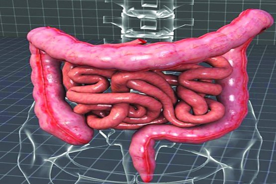 معرفی دارویی گیاهی برای درمان‌ «سندرم روده تحریک‌پذیر»