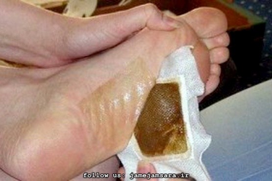 چسب حجامت از ادعا تا واقعیت