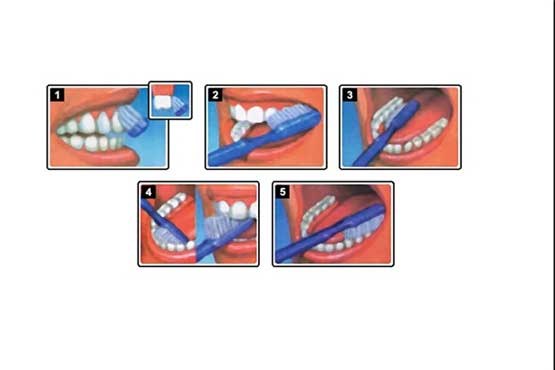 درست مسواک زدن را همین حالا یاد بگیرید
