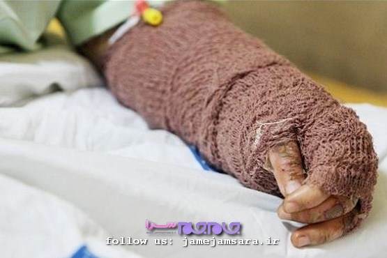 خراش سوءظن بر «سیما»ی دختر جوان [مجموعه‌عکس]