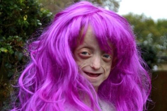 این پیرزن فقط 11 سال دارد [+عکس]