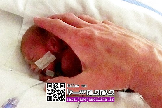 کودک معروف به «بندانگشتی» یکساله شد [+عکس]