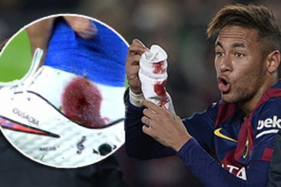 مصدومیت دردناک نیمار +[مجموعه عکس]