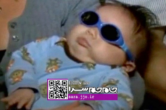 تولد نوزاد بدون چشم در آمریکا [+عکس]