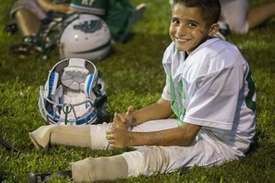 پسری که بدون پا فوتبال بازی می کند +[مجموعه عکس]