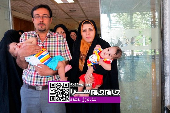 یک سال تلاش برای جداسازی دوقلوهای شیرازی [+عکس]