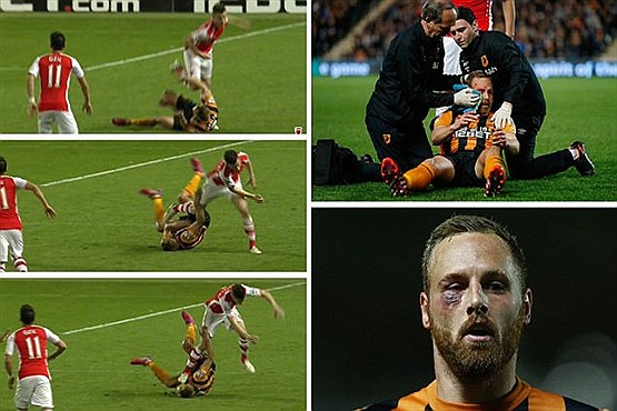 مصدومیت ناگوار یک بازیکن +[مجموعه عکس]