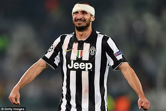 ستاره متعصب یوونتوس +[مجموعه عکس]