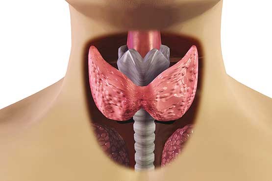 هشدار نسبت به علائم بروز سرطان تیروئید