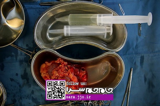 ضربان معکوس برای زندگی [عکس]