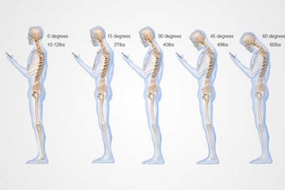تاثیر استفاده از گوشی روی ستون فقرات