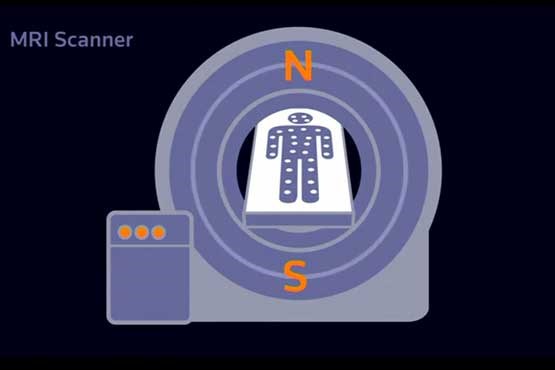 ام آر ای جدید با قابلیت تشخیص سریع تر بیماری ها