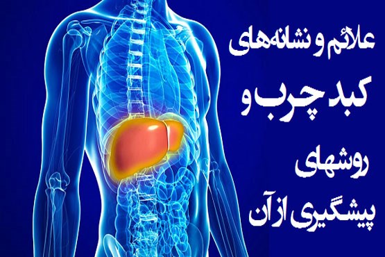 کبد ساکنان این سه شهر چرب تر است! / +توصیه های غذایی