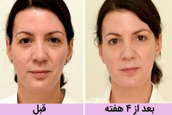 10سال جوان‌تر با این راهکارهای شگفت‌انگیز