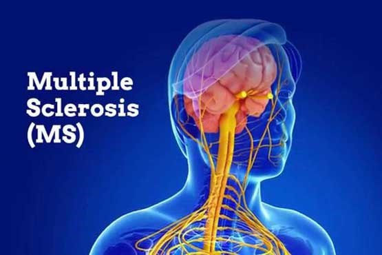 ورزش‌های تعادلی برای بیماران MS مفید است
