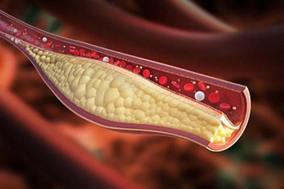 ژنی که کلسترول را از قلب دور می‌کند
