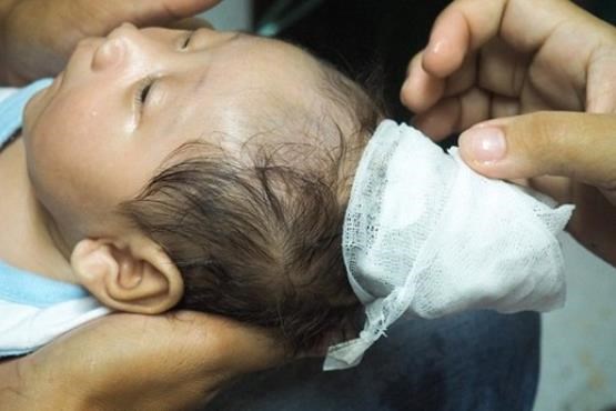 تولد نوزاد شاخدار + عکس تولد نوزاد شاخدار + عکس