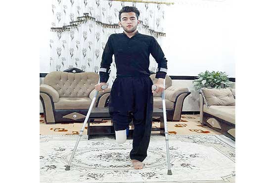 مگیر خرده که یک پا و یک عصا دارم...