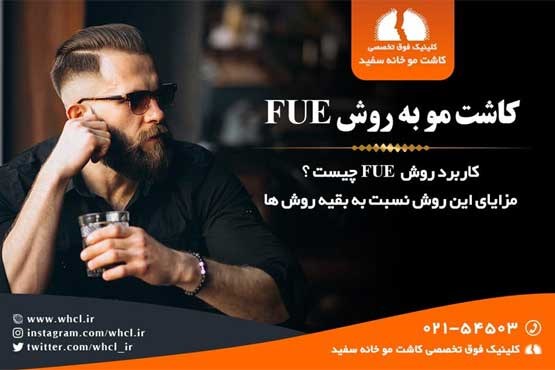 مختصری در مورد کاشت مو به روش Super FUE