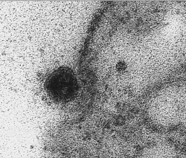 لحظه ورود کووید ۱۹ به سلول ثبت شد (+عکس)