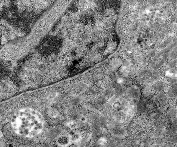 لحظه ورود کووید ۱۹ به سلول ثبت شد (+عکس)