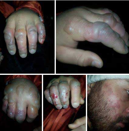 کوهنوردان یخ بسته در ارتفاعات تهران (تصاویر)