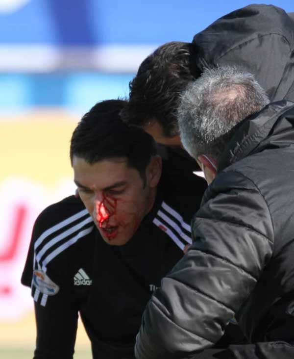 مصدومیت شدید اخباری (+تصاویر)