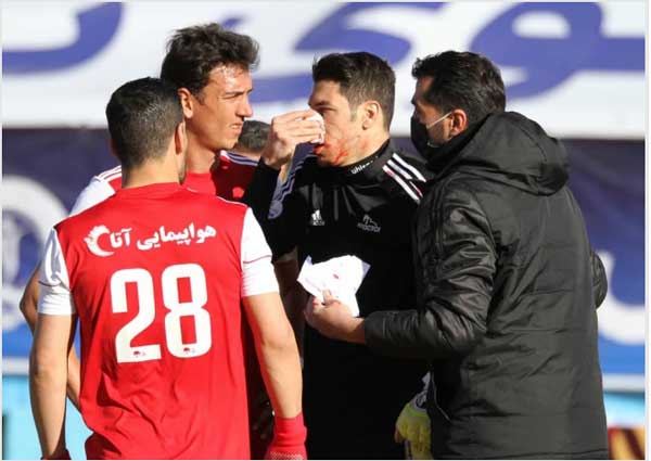 مصدومیت شدید اخباری (+تصاویر)