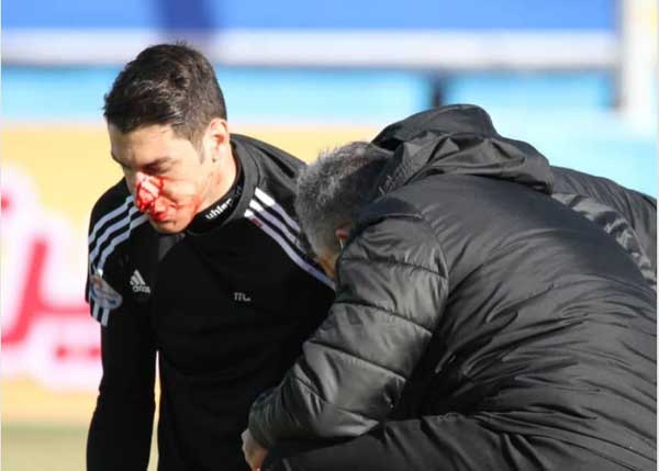 مصدومیت شدید اخباری (+تصاویر)