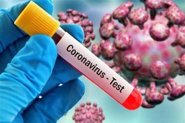 سخنگوی وزارت بهداشت شناسایی ۲۴۷۲ بیمار جدید مبتلا به کووید ۱۹در کشور خبر داد و گفت: متاسفانه در طول ۲۴ ساعت گذشته، ۱۰۷ بیمار کرونایی  جان خود را از دست دادند.