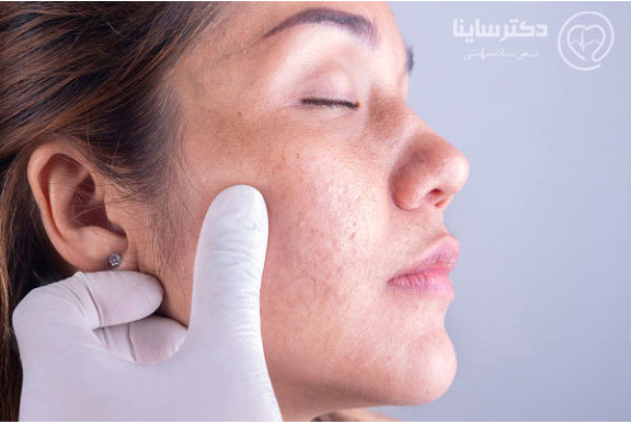 با بهترین دکتر های پوست و مو به صورت آنلاین صحبت کنید!