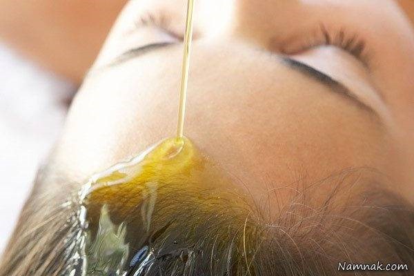 علت شوره سر و درمان آن به روش های کاملا طبیعی