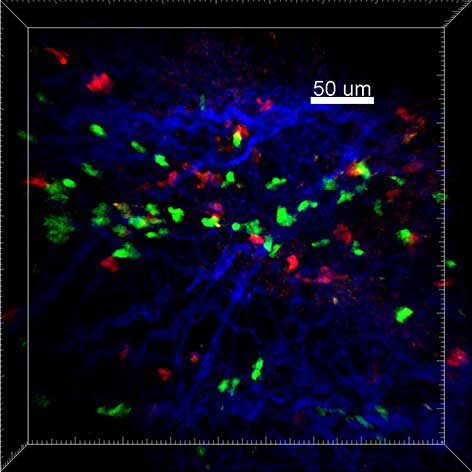 درمان بیماری «ام‌اس» با کمک سلول‌های «تی» (+عکس)