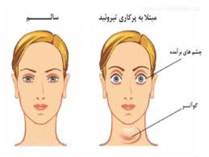 هورمون‌های تولید شده توسط تیروئید تمام عملیات سوخت و ساز بدن را کنترل می‌کنند؛ علاوه بر آن کنترل دمای بدن، ضربان قلب، انقباض و انبساط ریه‌ها، دستگاه گوارش، پوست و تقریبا تمام اندام‌ها بر عهدة این هورمون‌ها است.