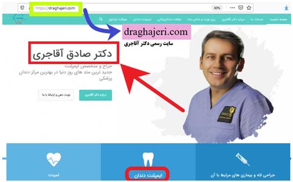 از سیر تا پیاز ایمپلنت دندان !! از سیر تا پیاز ایمپلنت دندان !!