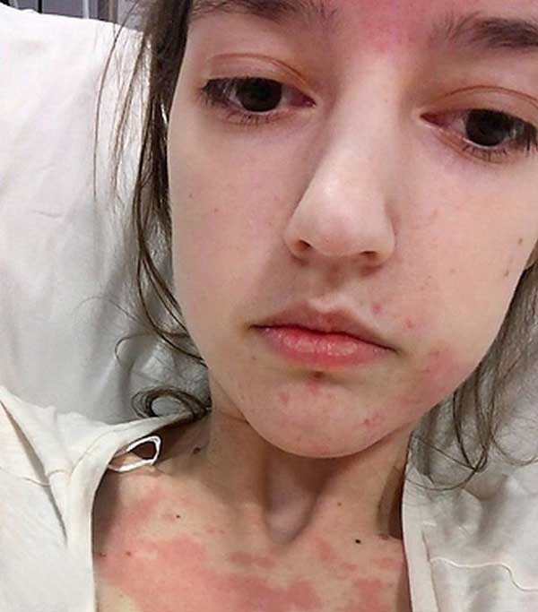 دختری که غذا را از طریق قلبش می‌خورد! (+عکس)