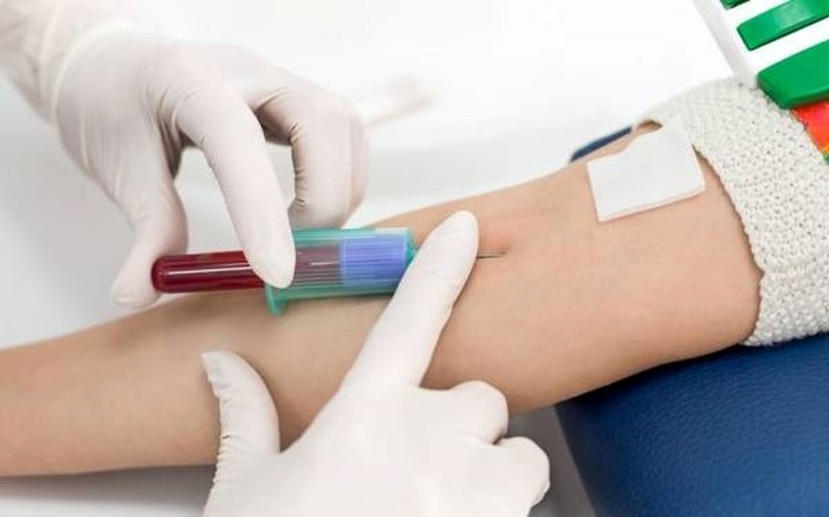 علائم، علل و درمان کبد چرب و ناسالم علائم، علل و درمان کبد چرب و ناسالم