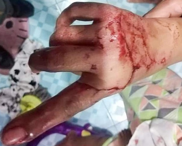 حمله خونین مار پیتون به زن خانه دار تایلندی