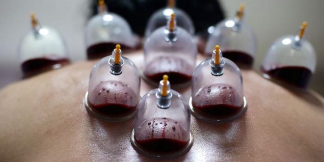 علائم نیاز بدن به حجامت در پاییز علائم نیاز بدن به حجامت در پاییز