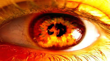 آثار و پیامدهای سوء آثار و پیامدهای سوء