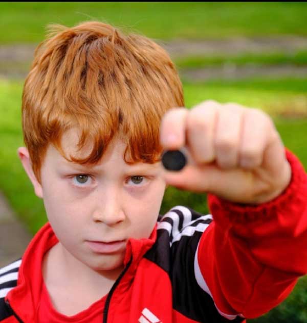 سرنوشت جالب پسربچه پس از قورت دادن یک باتری! (+عکس)