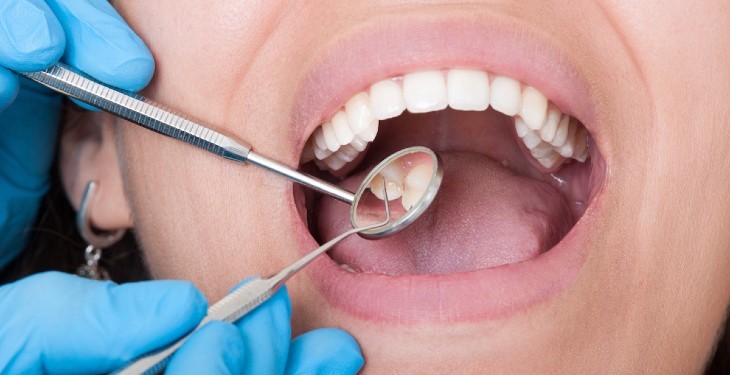 چگونه مینای دندان خود را سالم نگه دارید؟