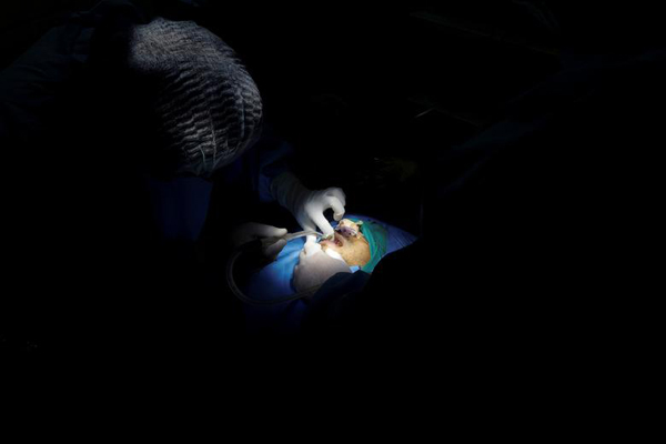 جراحی بر روی بیمار مبتلا به قارچ سیاه / کودکان یخی (گزارش تصویری)