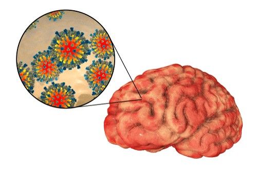 سرخک چیست (شایعترین بیماری عفونی از طریق تنفس) و چه درمانی دارد؟ سرخک چیست (شایعترین بیماری عفونی از طریق تنفس) و چه درمانی دارد؟